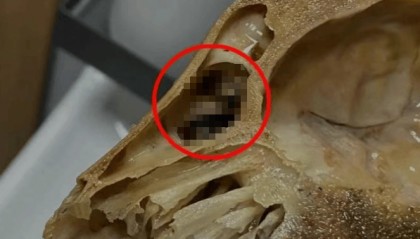 吃完发现全是蛆，恶心呕吐一整夜！上海法院判了：赔1000元