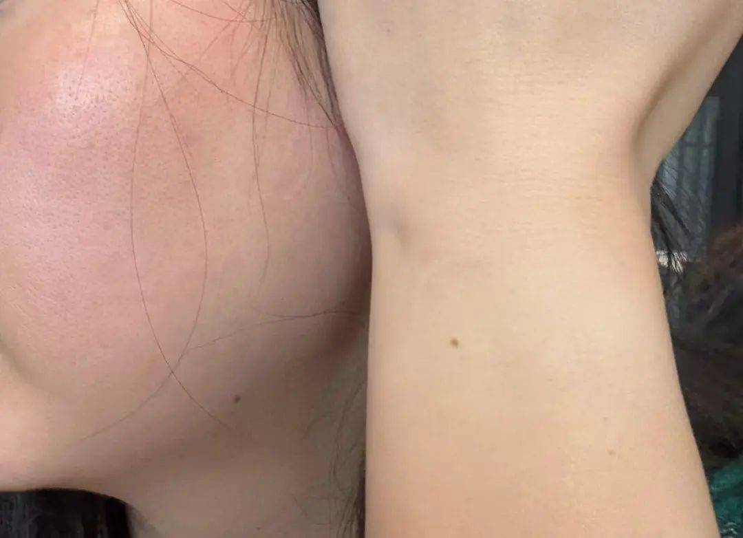 【早读】防晒面罩越戴越黑！热黑的还是捂黑的？